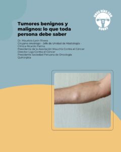 Lee más sobre el artículo Tumores benignos y malignos: lo que toda persona debe saber