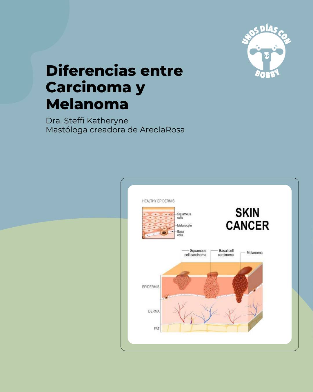 En este momento estás viendo Diferencias entre Carcinoma y Melanoma
